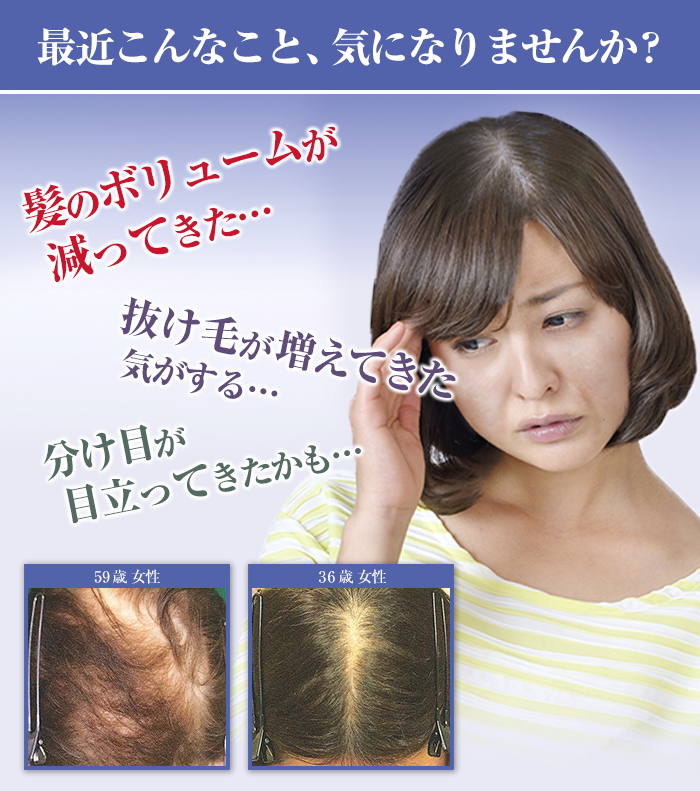 「髪のボリュームが減ってきた」「抜け毛が増えた」「分け目が目立ってきた」などのお悩みはありませんか?